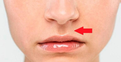 Mengenal Fungsi Filtrum, Lekukan Antara Bibir dan Hidung